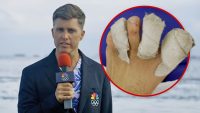 colin-jost-calls-himself-‘leper’-after-olympic-injuries-and-infections