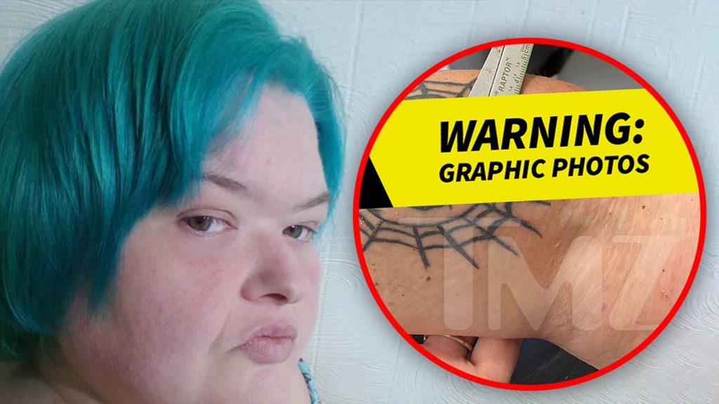 first-look-at-‘1000-lb-sisters’-star-amy-slaton’s-wound-from-‘camel-bite’