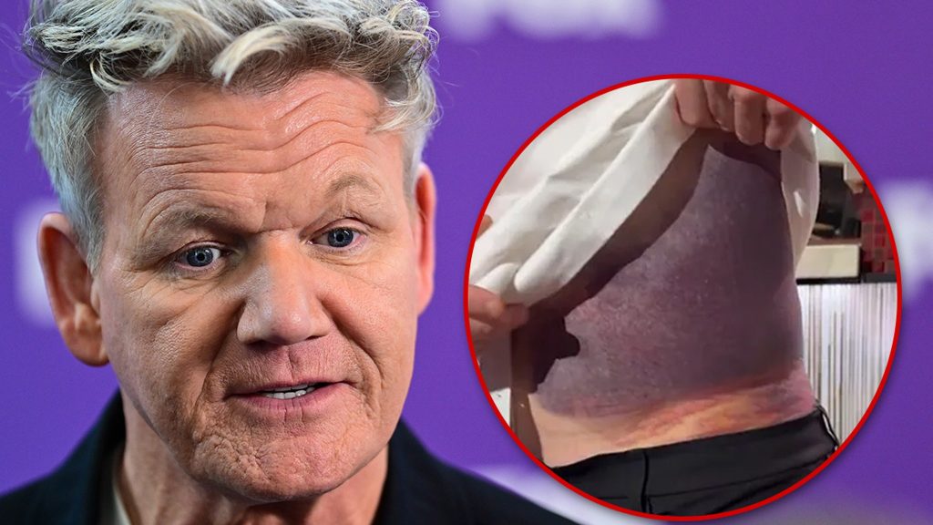 gordon-ramsay-details-bloody,-painful-aftermath-of-bike-crash